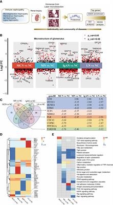 Global-feature of autoimmune glomerulonephritis using proteomic analysis of laser capture microdissected glomeruli